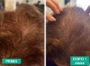 Spray per capelli con peptidi