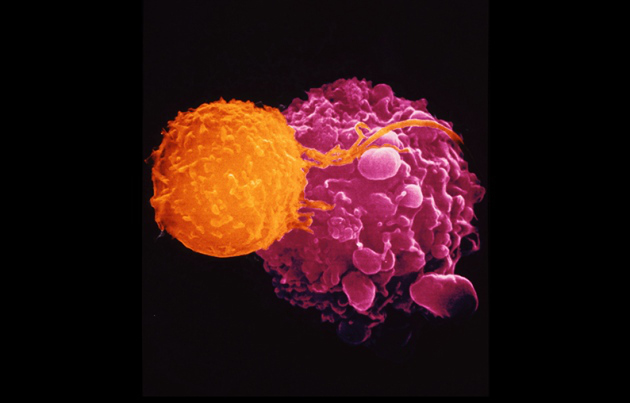Cellula T (arancione) che uccide una cellula tumorale (in rosa acceso).